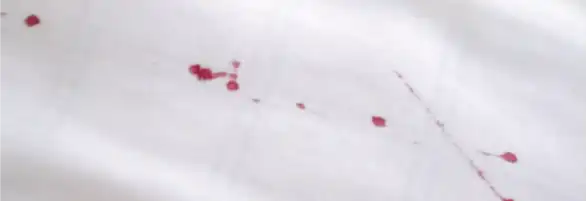 床蝨有機會在床上留下血點